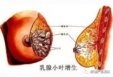 乳头乳房及肝经循行之处,女子以肝为先天,肝藏血主疏泄,体阴而用阳