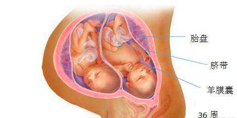 婆婆怀疑孕妈肚里双胞胎是女孩,7个月强迫去减胎