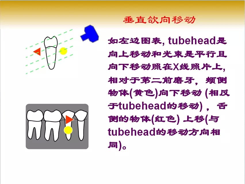 口腔x线片拍摄定位技巧