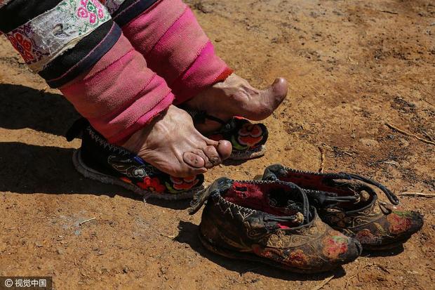 裹足,又称缠足,裹脚,裹小脚,是中国古代的一种陋习,即把女子的双脚用