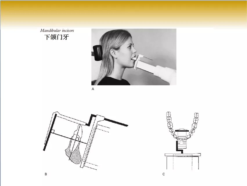 口腔x线片拍摄定位技巧
