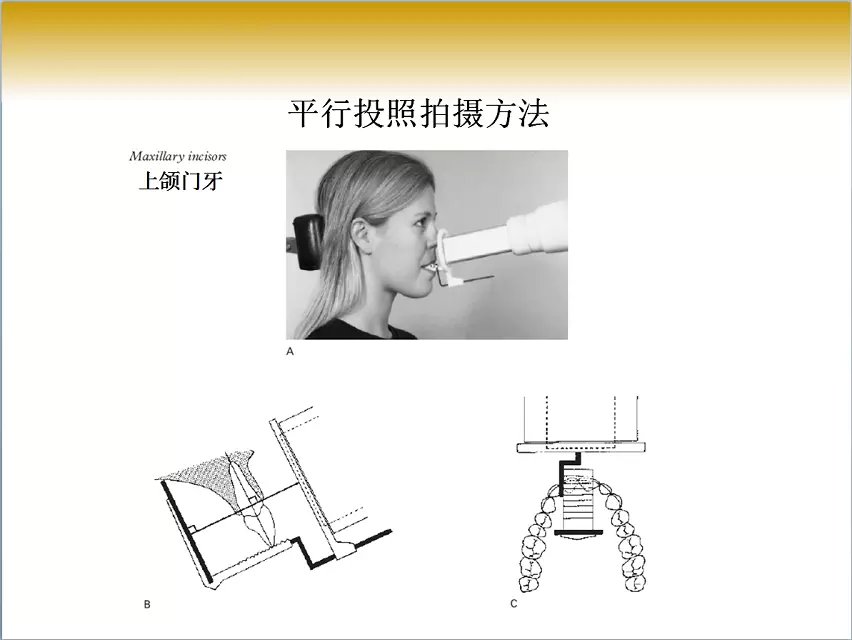 口腔x线片拍摄定位技巧