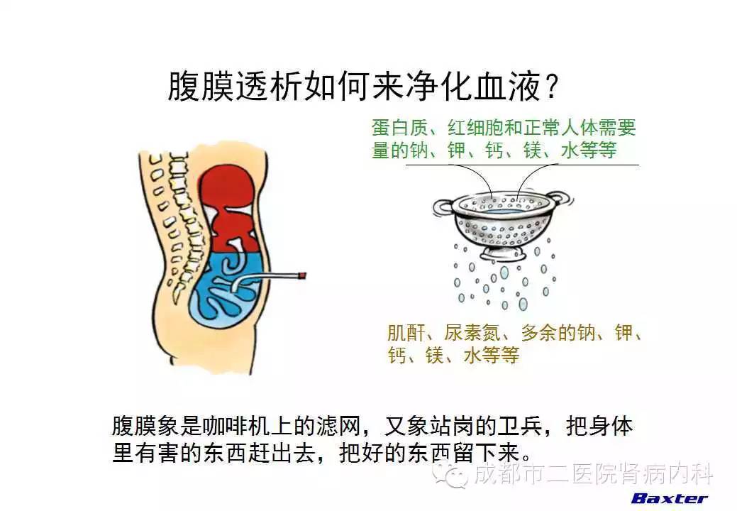 血液透析和腹膜透析,哪个适合我?