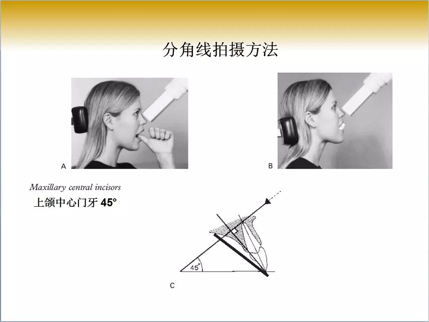 口腔x线片拍摄定位技巧