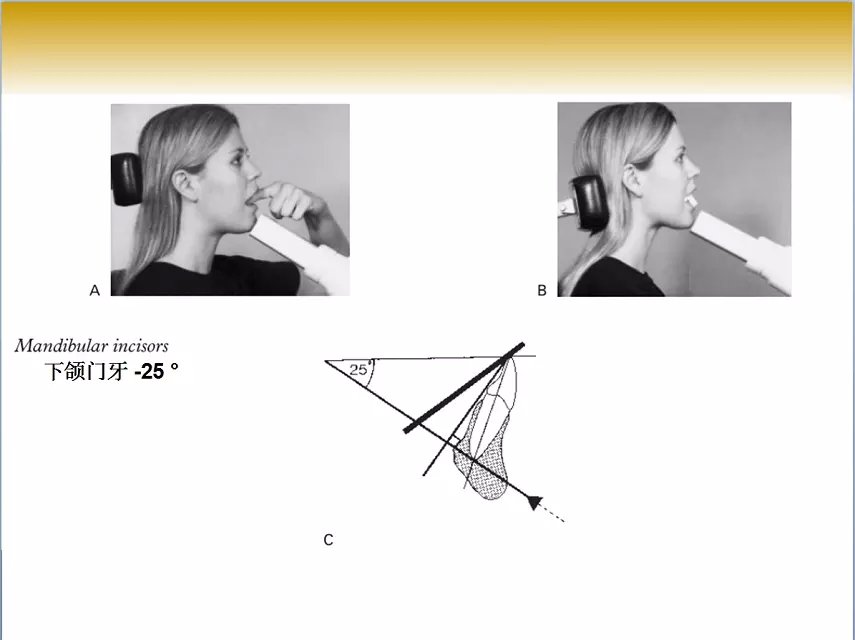 口腔x线片拍摄定位技巧