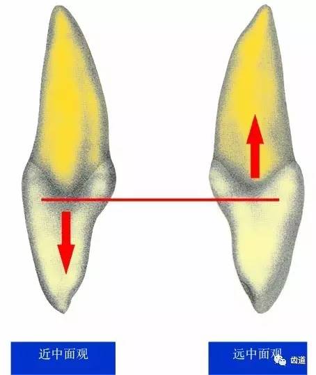 五)舌侧边缘嵴高度的对比 在远中面能看到近 中边缘嵴的起源 因此,近