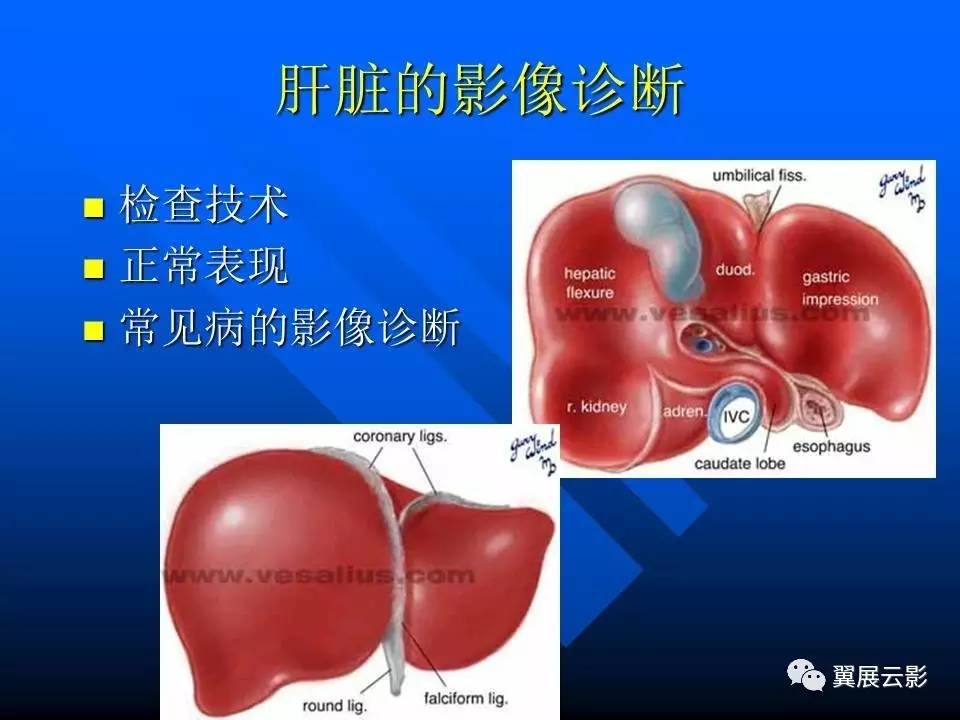 肝胆胰脾的影像诊断