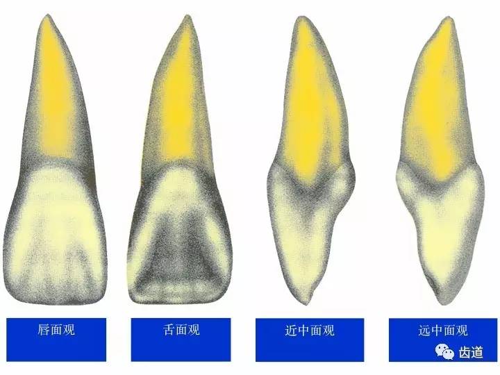 一颗牙的解剖91上颌中切牙解剖形态特征