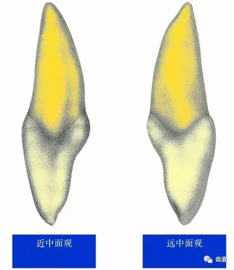 上颌中切牙(maxillary central incisor) 上颌中切牙牙体形态特征五面