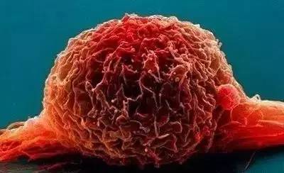 癌细胞的真面目长这样子!