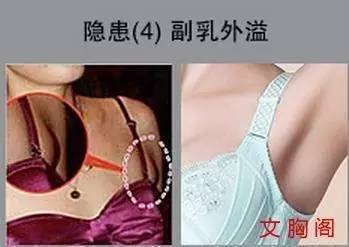 有副乳穿什么内衣好(3)