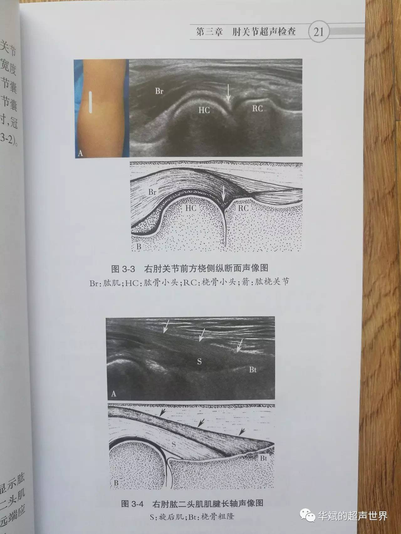 《中国肌骨超声检查指南》的幕后英雄