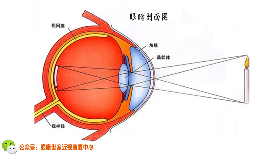 视力矫正教你改变眯眼睛的习惯