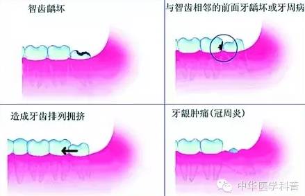 智牙图片