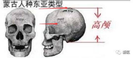 而高颅的人,从眼睛往上的空间较高,给发际线往上的颅顶预留高度就较高