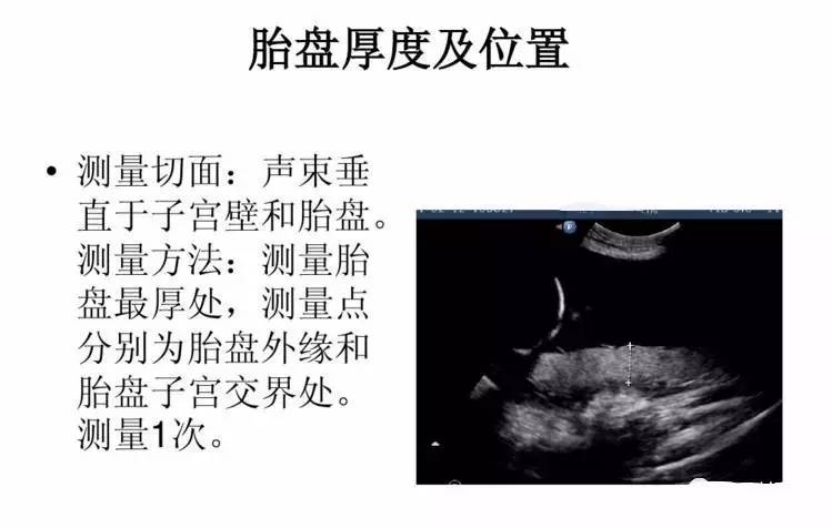 孕期各项超声检查标准切面,还看不懂报告的孕妈进