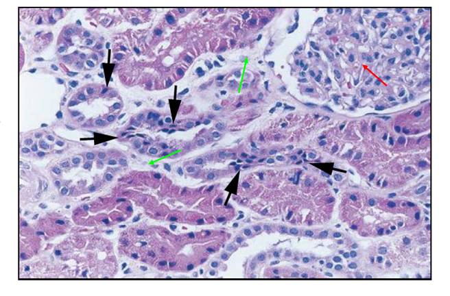 绿色箭头:肾间质水肿;黑色箭头:肾小管内压缩的呈三角形状的凋亡细胞