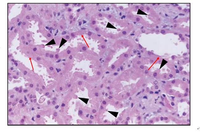 he染色:红色箭头:肾小管上皮细胞脱落处;黑色箭头:肾小管上皮细胞