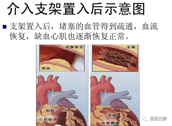 心脏搭脉怎么治疗_心脏位置(2)