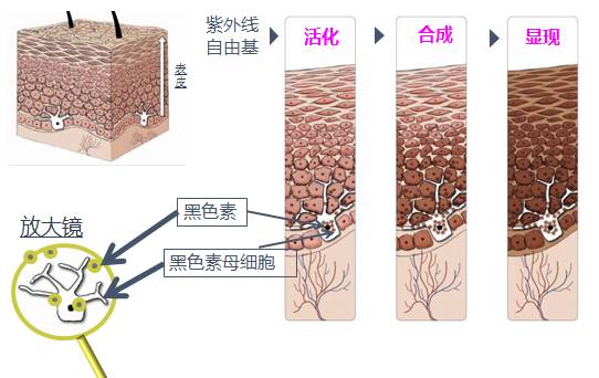 皮肤色斑元凶-黑色素