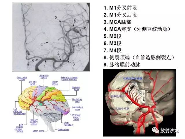 必收藏 | 最全的脑动脉分段,分支图解!