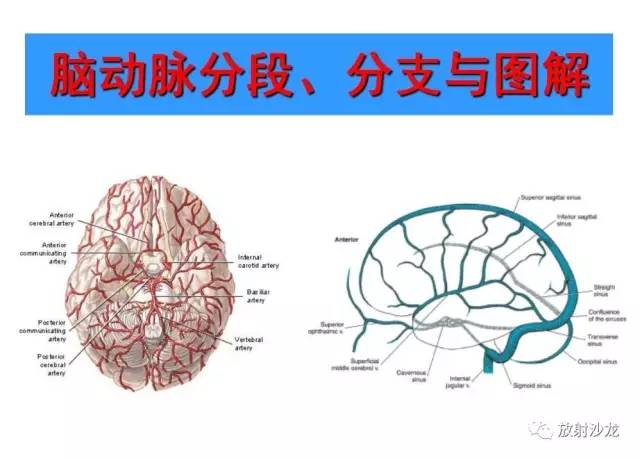 必收藏 最全的脑动脉分段,分支图解!