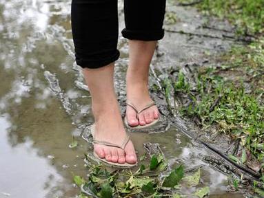 夏季雨天穿拖鞋易得关节炎