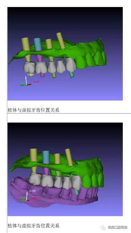 岳阳口腔医院采用芬兰进口的普兰梅卡cbct,全景机,瑞士进口iti种植体