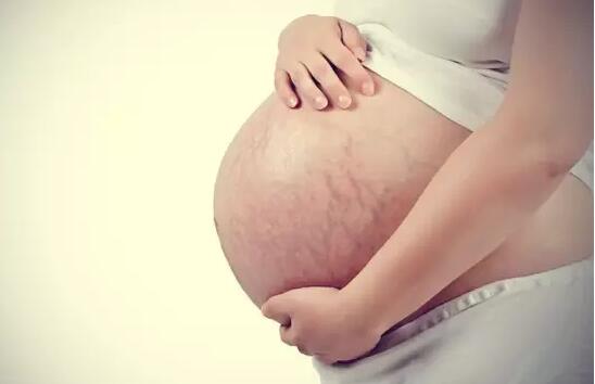怀孕有妊娠纹怎么办