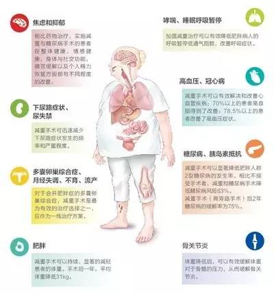 除了致病还致命!世卫组织称肥胖会减寿6-7年