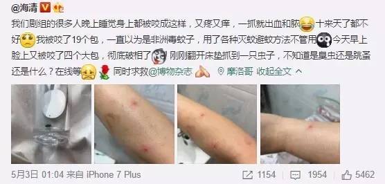 海清被虫子咬了微博求助,博物君:可能是臭虫!小编亲测