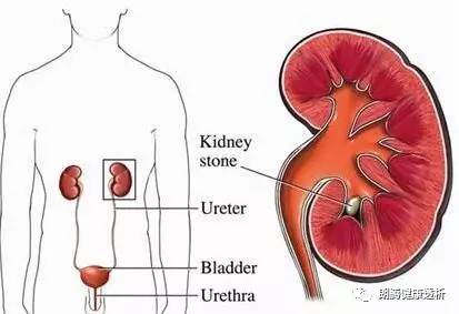 男性肾异常12个信号