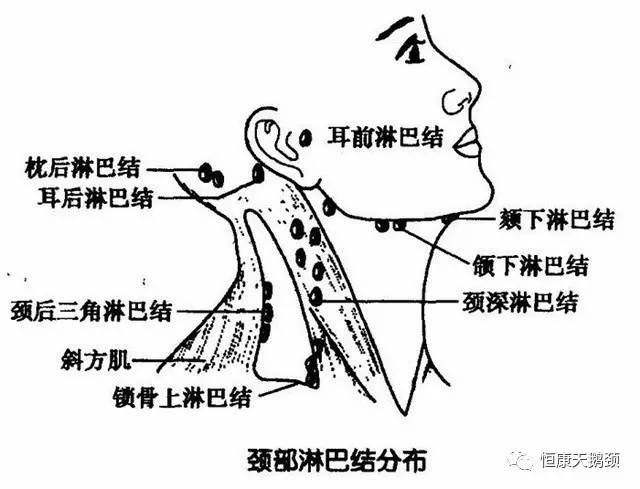 颈部淋巴,比较集中的部位分别是耳前耳后,腮边,下颌,颈身,后颈等;当