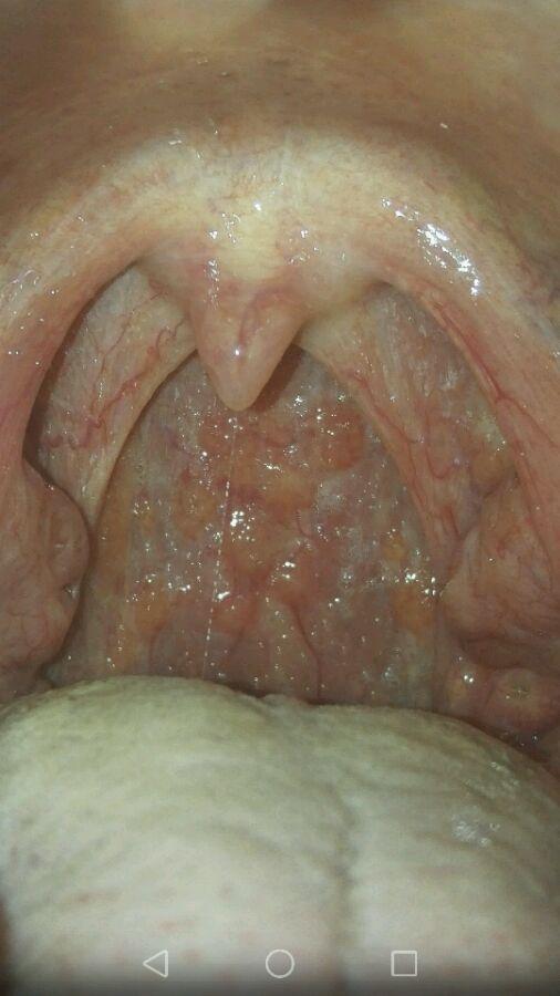 喉咙  (上面是我去医院检查的结果,咽炎已经没有了)  你还在等什么呢?