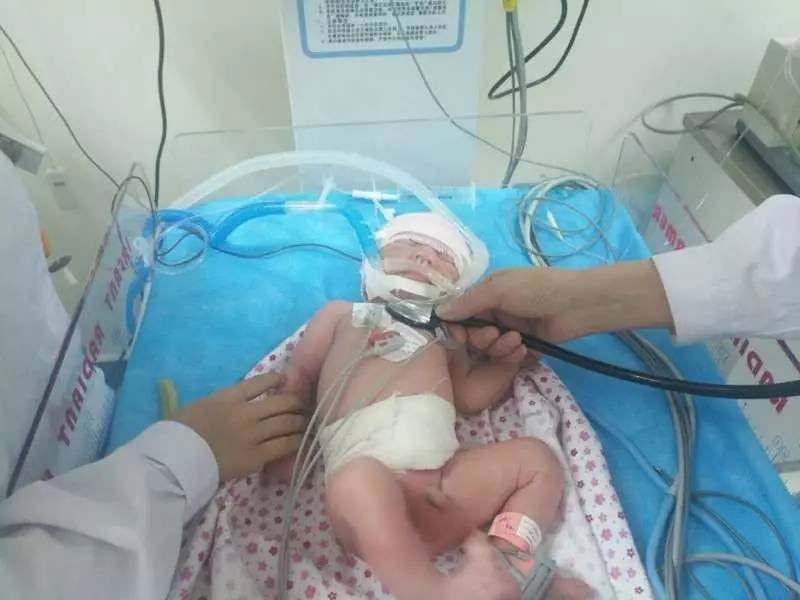 我院儿科使用无创小儿呼吸机成功救治32周早产儿