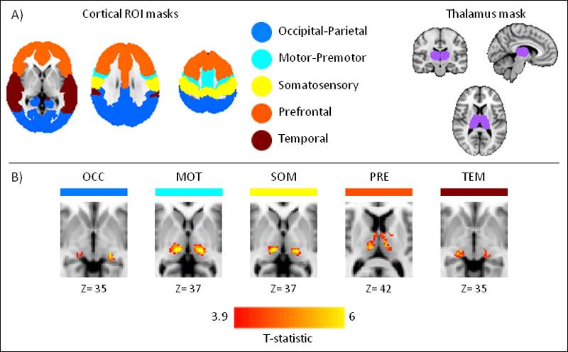 【微课】睡眠影响丘脑的同步EEG-fMRI研究