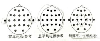 电脑图标不见了怎么恢复_电脑图标变大了怎么还原_ERP脑电图