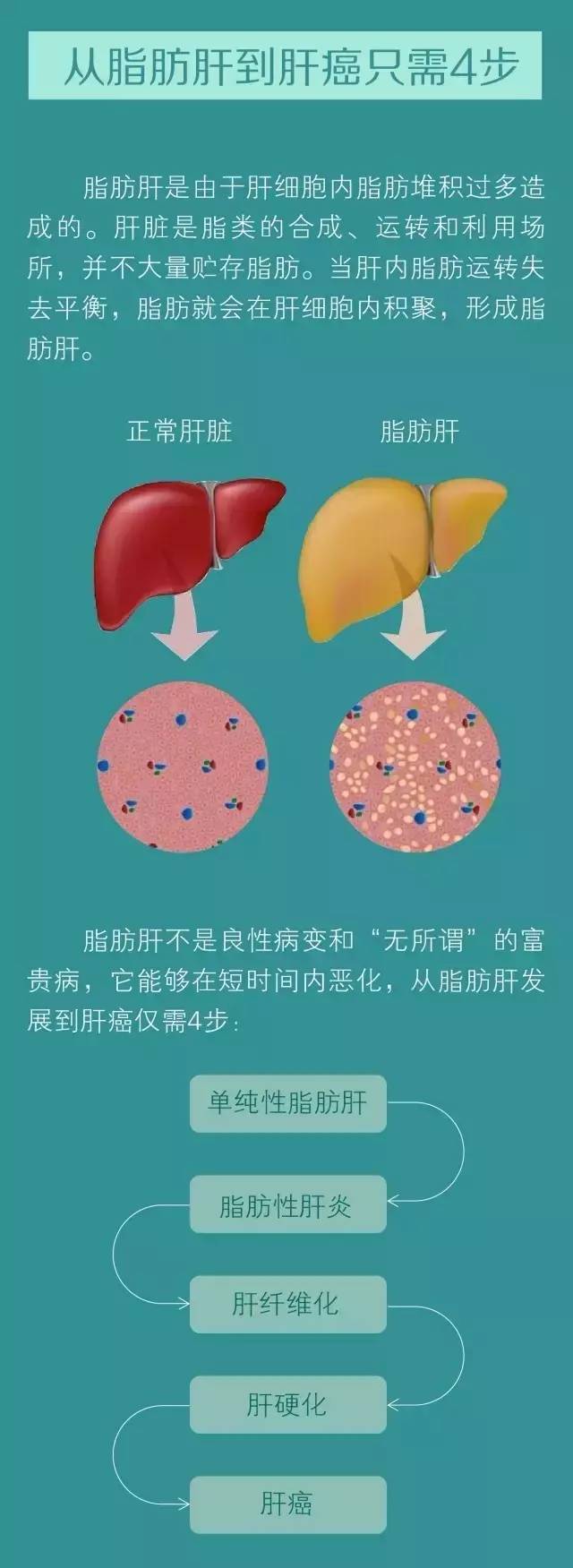 有约 50% 的患者会出现肝脏肿大,医生可以触摸到肿大的肝脏.