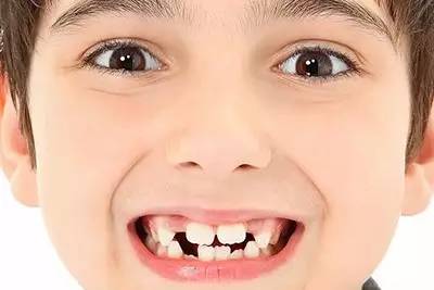牙齿萌出一段时间后,锯齿部位将自然磨平.
