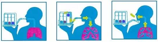 呼吸训练器 呼吸肌的训练,除了上述方法,现在市面上还有各种简便型的