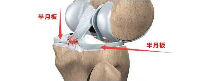 因为形状跟月亮一样,所以称为半月板.
