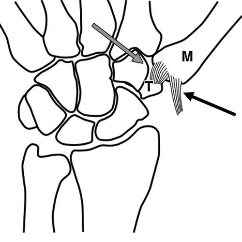 拇指韧带ligaments of the thumb