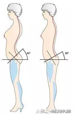 足部的位置和腰部周边肌肉到底如何影响我们的姿势