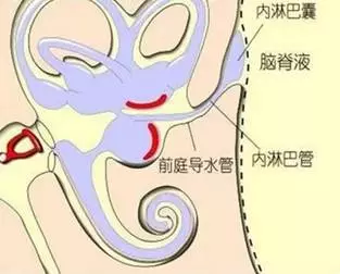 前庭导水管位置图