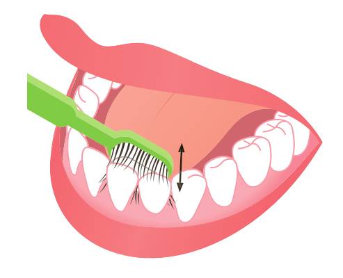 臼齿:平握牙刷,刷毛尖端呈直角在牙齿间插动.
