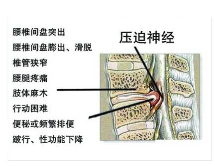 人口阻滞模型_模型预测论文,改进阻滞增长模型对人口数量和结构的预测有关论(3)