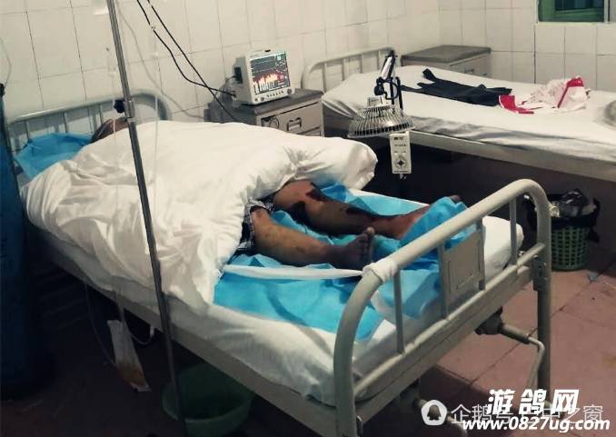 巴中市通江县一大爷腿烂生蛆,4女1儿却无人管