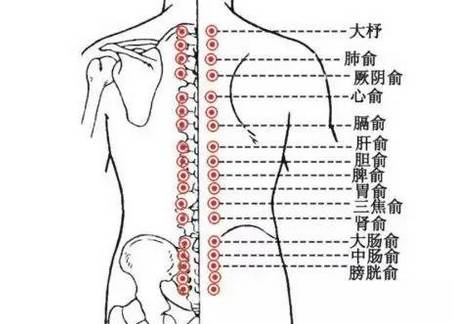 拔罐方法不对=缩短生命,中医提醒,拔火罐警惕四个禁忌