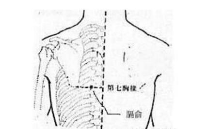 湿疹出黄水怎么办