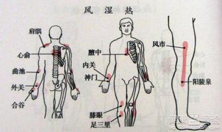 小儿风湿热的严重危害你知道吗?妈妈们要注意